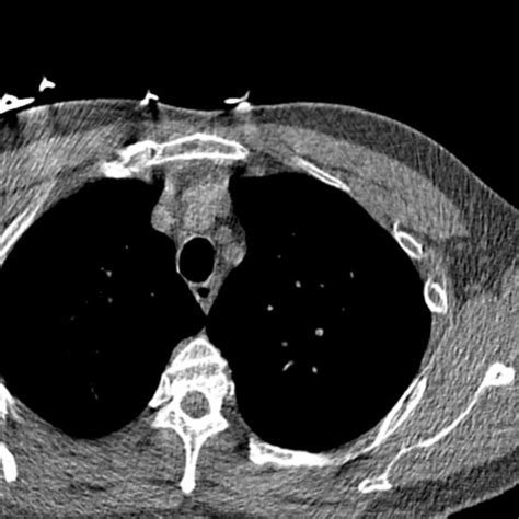 CT Thorax - DocCheck