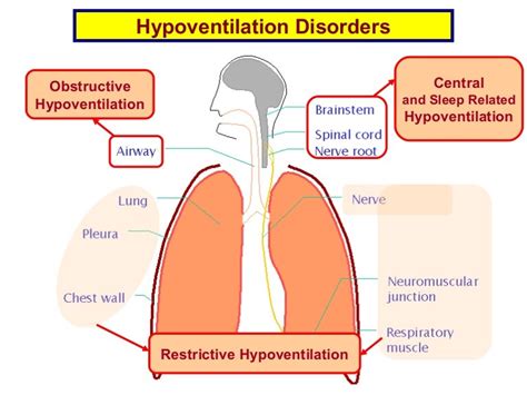 1 hypoventilation disorders