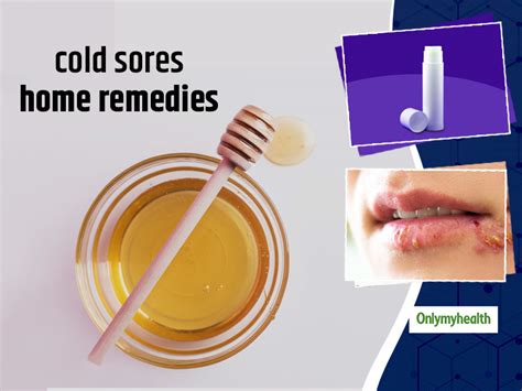 Useful Home Remedies To Get Rid Of Fever Blisters Or Cold Sores ...