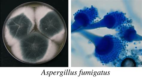 Aspergillus: Morphology, Clinical Features, and Lab Diagnosis • Microbe ...