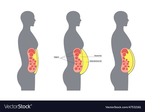 Visceral fat diagram Royalty Free Vector Image