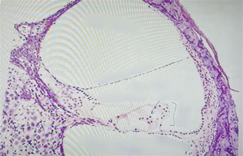 Cochlea Histology #2 Diagram | Quizlet