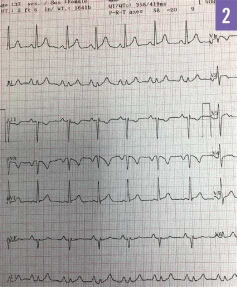 Interactive Quiz: Dizziness, Palpitations, and Syncope | Consultant360