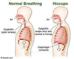 What Causes Hiccups? | SiOWfa16: Science in Our World: Certainty and ...