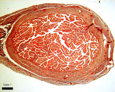 Ndens Blog: fallopian tube test