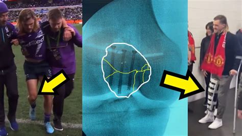 Ryan Papenhuyzen's Kneecap Surgery Explained!