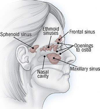 Acute Sinusitis - Harvard Health