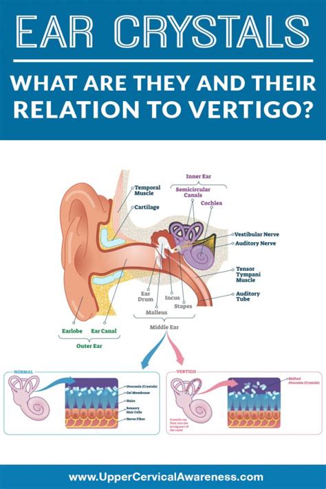 Ear Crystals: What Are They and Their Relation to Vertigo?