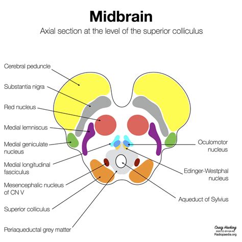 Brainstem Aura