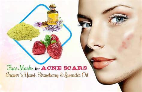 32 Natural Face Masks For Acne Scars At Home