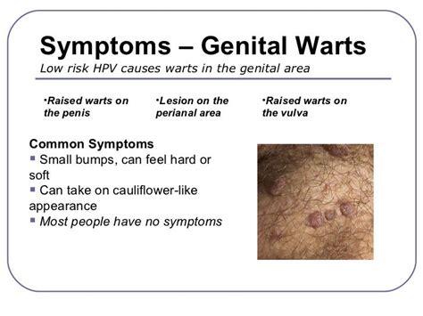 Understanding Genital Warts: Symptoms, Causes, and Treatment - Ask The ...