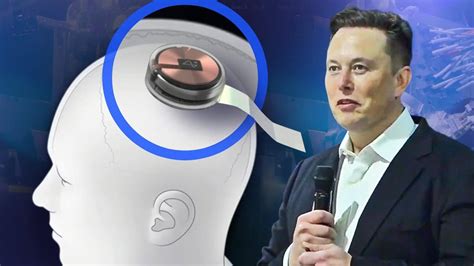 Elon Musk's Chip Could Help People With Disabilities