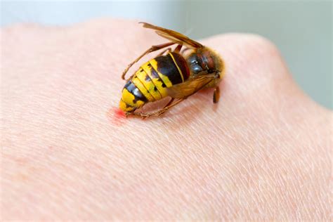 INSECT STINGS - WatsonsHealth