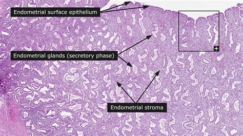 Uterus Histology Secretory Phase