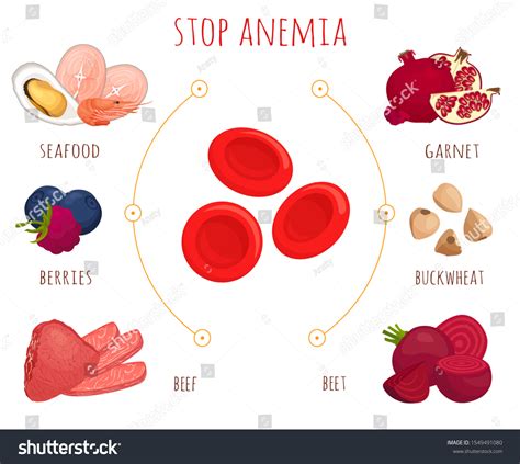 Stop Anemia Concept Infographics On Topic Stock Vector (Royalty Free ...