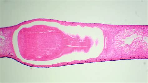 Cross Section Of Planarian Under The Microscope (Planaria C.S.), Full ...