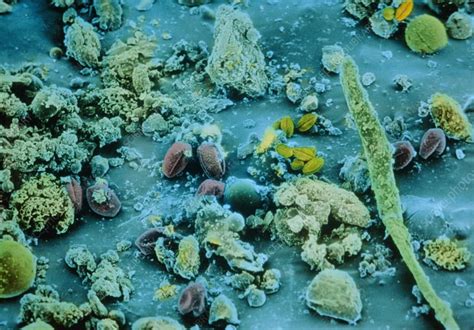 F/col SEM of allergens: dust, pollen, fungal spore - Stock Image - M320 ...