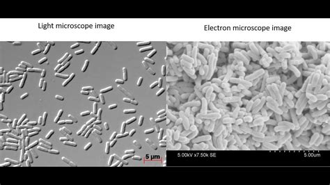 What do bacteria look like under a light vs electron microscope? - YouTube