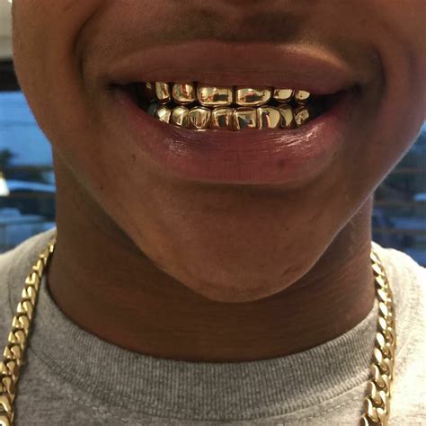 as i am...🎈 | Grillz, Grills teeth, Gold grillz