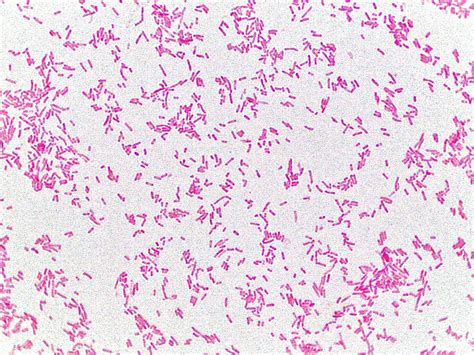 Pin on Escherichia coli Gram stain