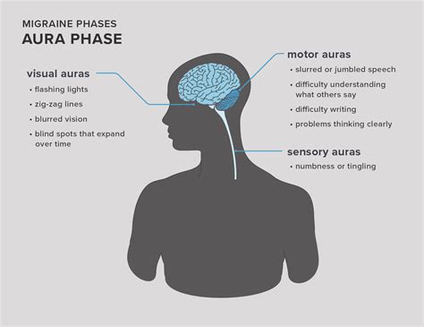 Ocular Migraine Blind Spot