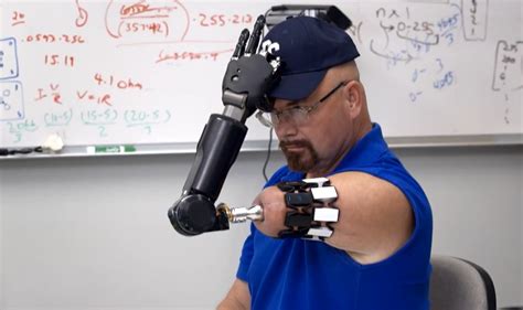 Here's the World's Most Advanced Bionic Arm