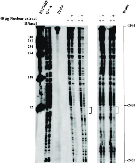 DNase I footprinting analysis of the À 2436/ À 1946 repressor region ...