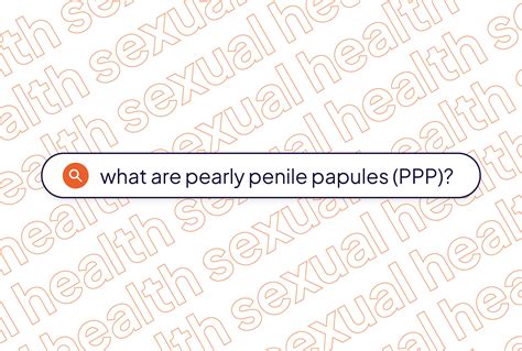 Pearly Penile Papules (PPP): Types, Symptoms, Causes, Diagnosis ...