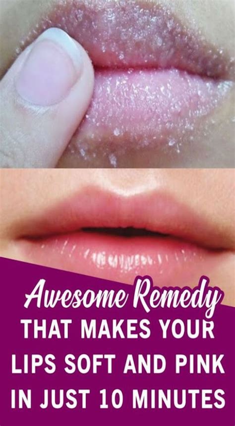 10 Effective Home Remedies for Pink Lips - Healthy Lifestyle