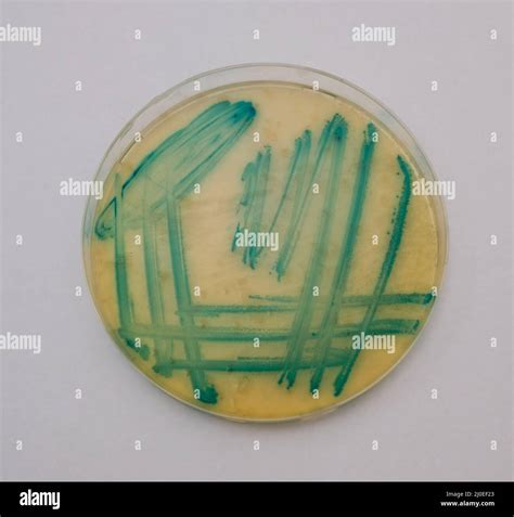 photo of growth of green bacterial colonies on nutrient agar Stock ...