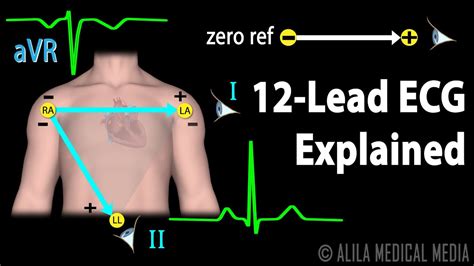 Lead Ekg Basics