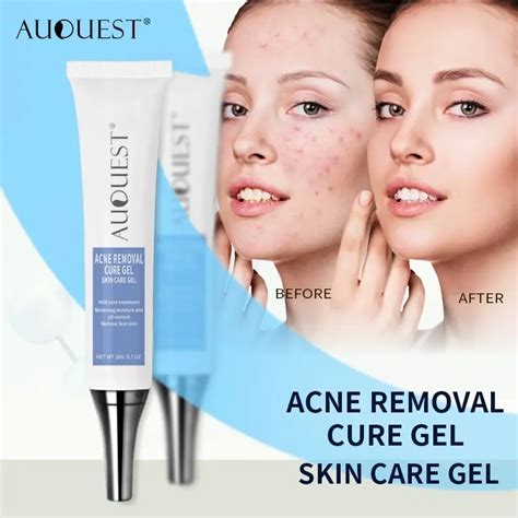 AuQuest Acne Removal Cure Gel Scar Marks Acne Treatment Repair Comedone ...