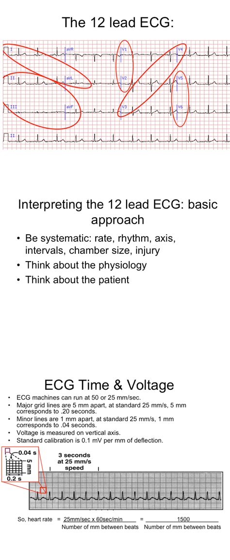 12 Lead ECG Interpretation ECG Interpretation #311