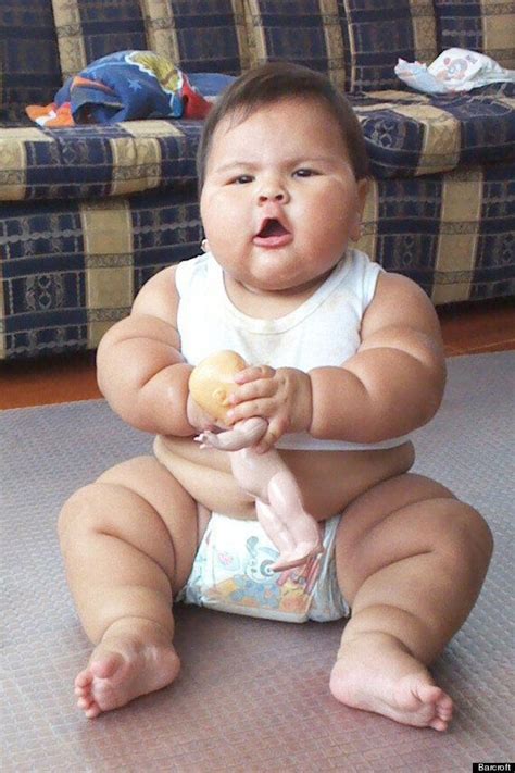 Obese Baby With Mystery Illness Weighs 20Kgs At Just 10 Months Old ...