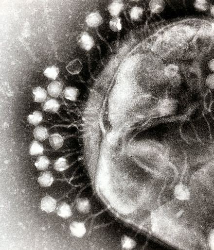 Phage therapy - Wikipedia