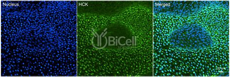 HCK antibody - BiCell Scientific®