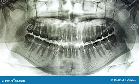 X-Ray scan human for teeth stock photo. Image of knee - 49682964