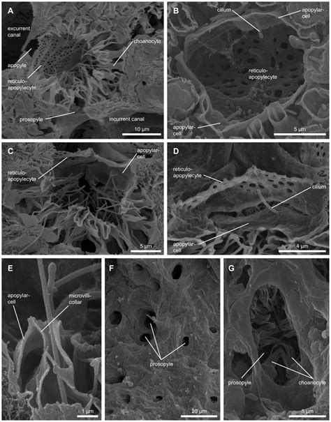 Scanning electron micrograph of cellular structures in the choanocyte ...