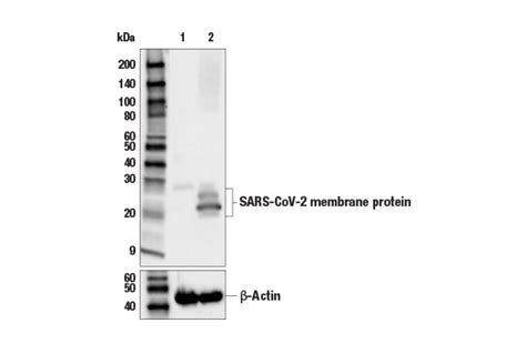 SARS-CoV-2 Membrane Protein (E3V5H) Mouse mAb | Cell Signaling Technology