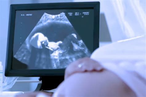 TIFFA Scan in Pregnancy - Why is it Important, Preparations, Procedure ...