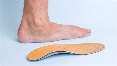 Flat Feet: Causes, Symptoms & Treatment | Foot & Ankle Group