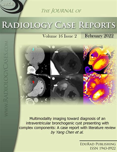 Journal of Radiology Case Reports