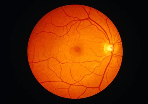 Retina Anatomy: Function and Associated Conditions