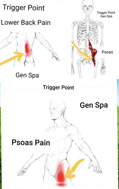 What is Psoas Syndrome? | Gen Spa