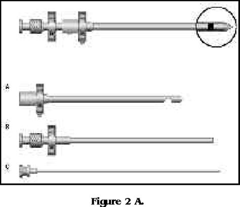 Figure 2 from PLEURAL EFFUSION AND ROLE OF CLOSED PLEURAL BIOPSY: A ...