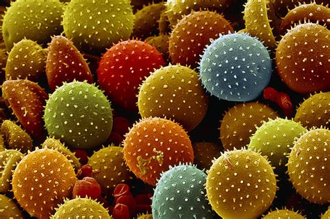 Rust Fungus Spores, Sem Photograph by Steve Gschmeissner