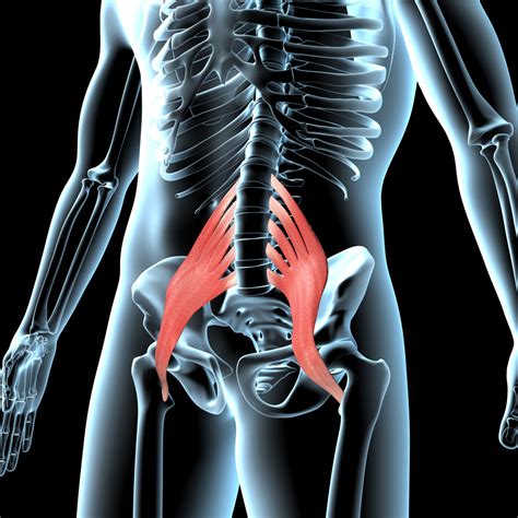 Iliopsoas Strain