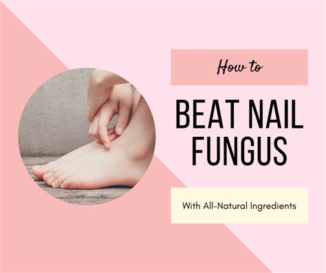 Toenail Fungus Treatment Coconut Oil - Quotes Update Viral