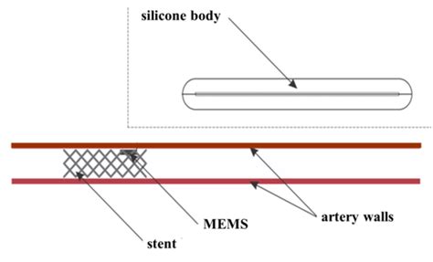 MEMS device design. Option 3 | Download Scientific Diagram