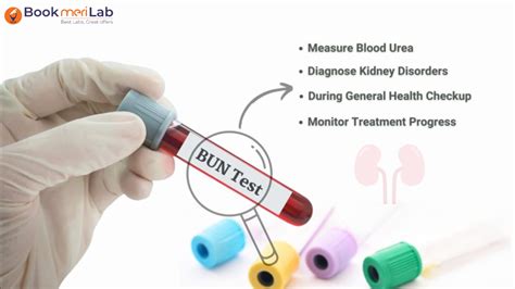 Blood Urea Nitrogen (BUN Test): Price, Purpose & Results [2024]